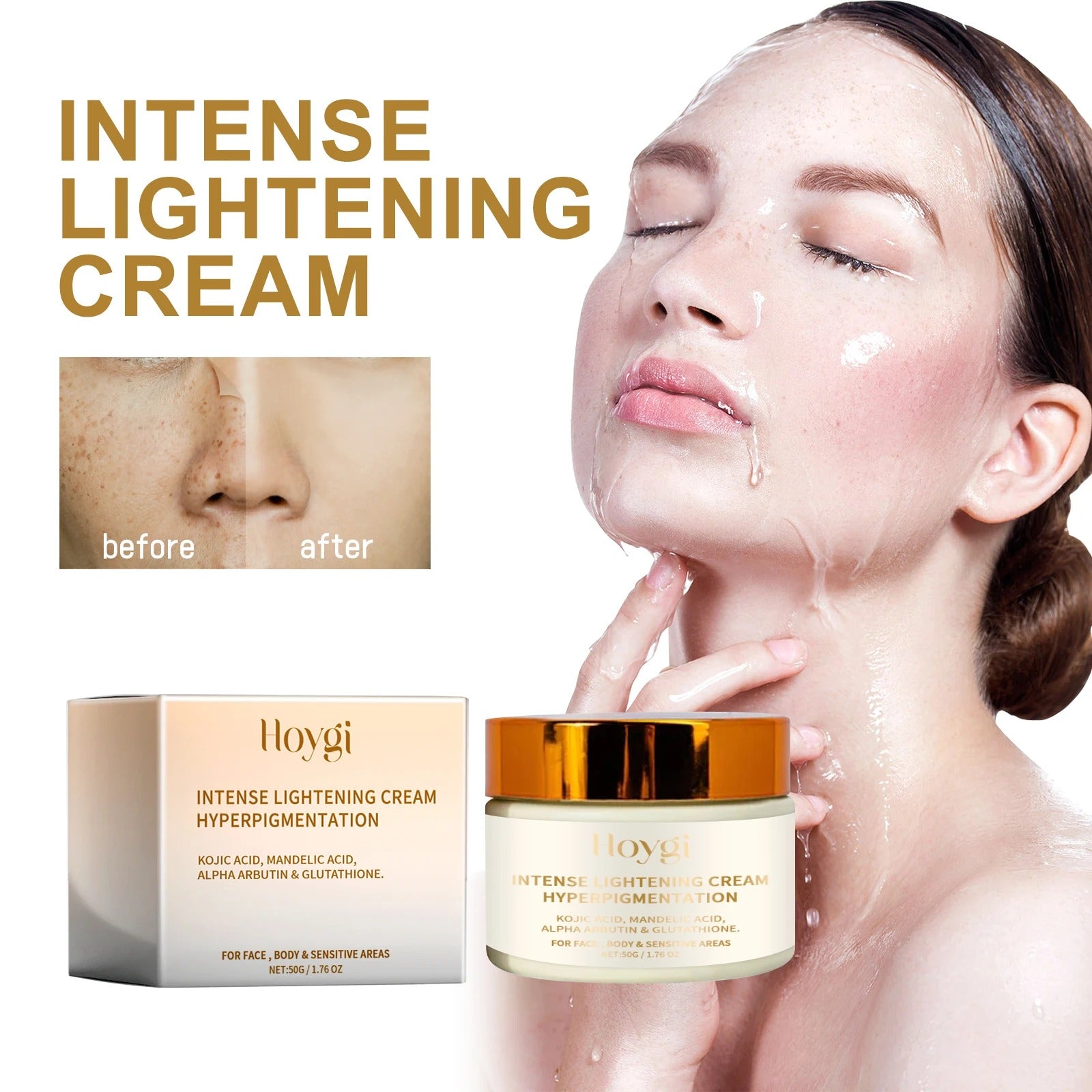 Hoygi Intense Lightening Cream – Face & Body