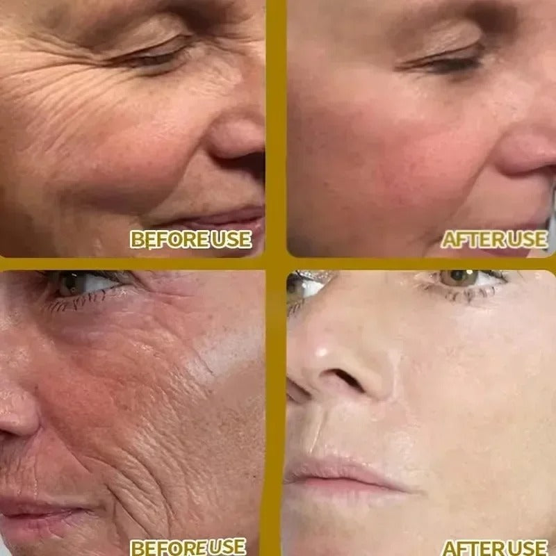 Retinol & Hyaluronic Acid Serum – Anti-Aging & Hydrating