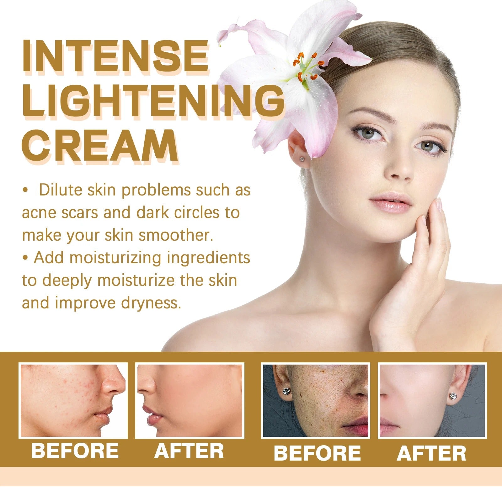 Hoygi Intense Lightening Cream – Face & Body